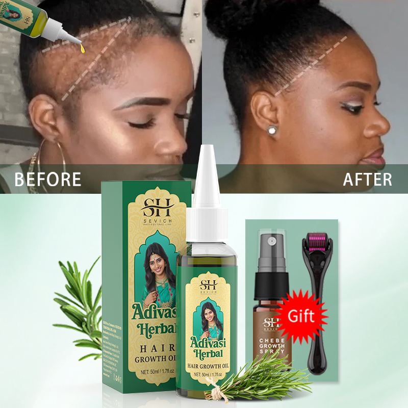 Ayurvedic Hair Growth Oil Indi - Hair Care Essence Oil review and price