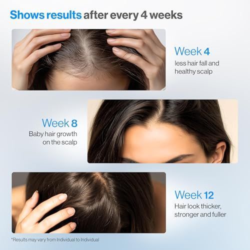 Premium Rosemary Anti-Hair Fal - Hair Care For Hair Fall review and price