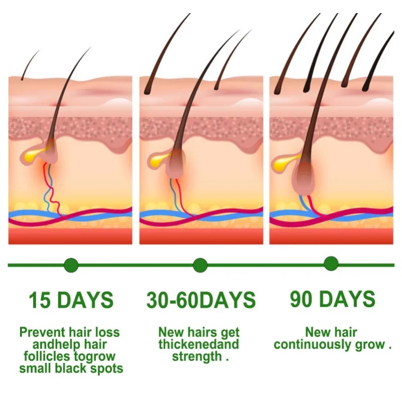 Hair Growth Serum Fast Growing - Hair Care Essence Oil review and price
