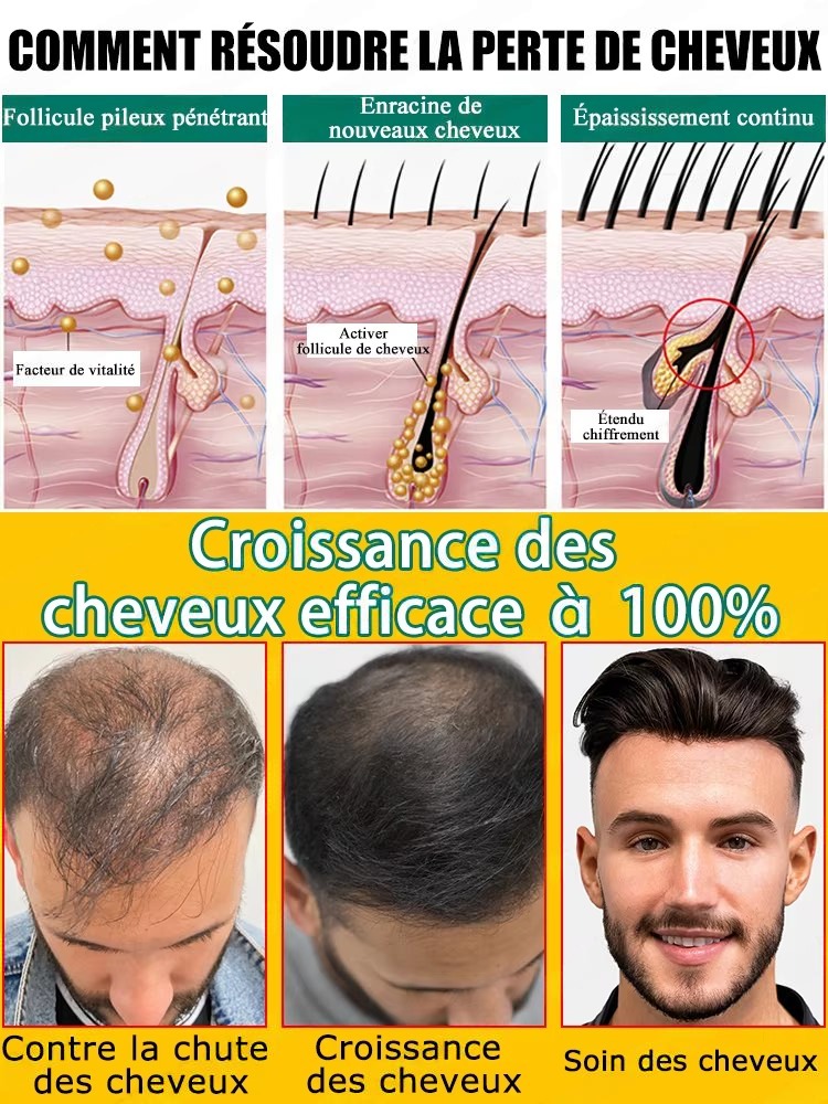 Anti Hair Loss Growth Serum, R - Hair Care For Hair Fall review and price