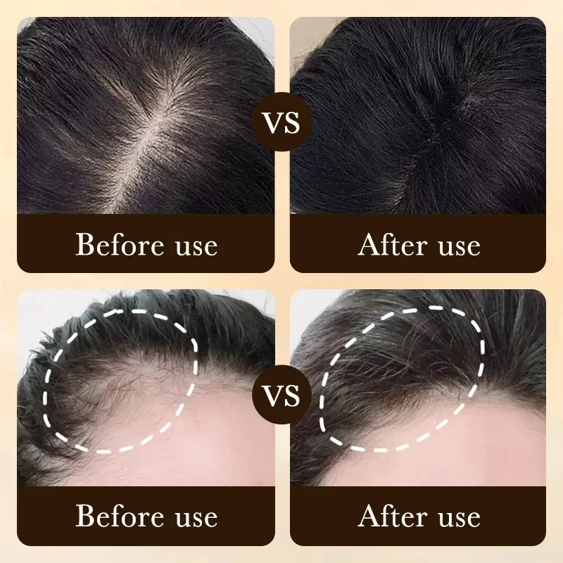 Biotin Fast Hair Growth Oil Pr - Hair Care Essence Oil review and price