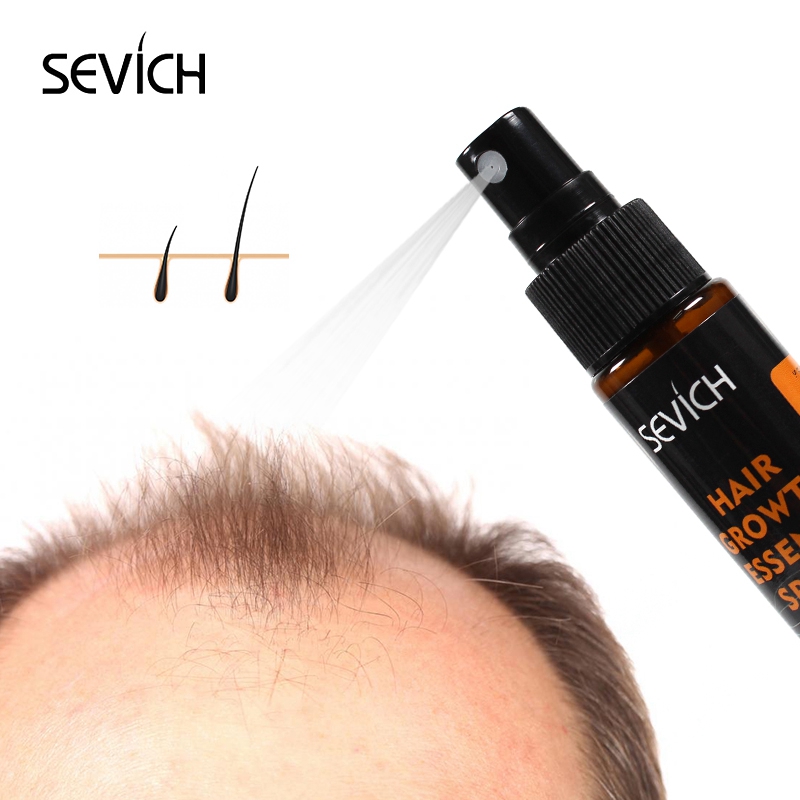 Sevich 30ml Hebal Oil Essence  - Hair Care Essence Oil review and price